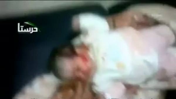 Suriyeli yaralı bebeğin metaneti şaşırttı