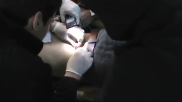 Suriye'de cep telefonu ışığında ameliyat