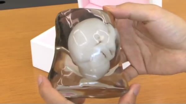 3D yöntemiyle doğum öncesi bebeği görmek artık mümkün