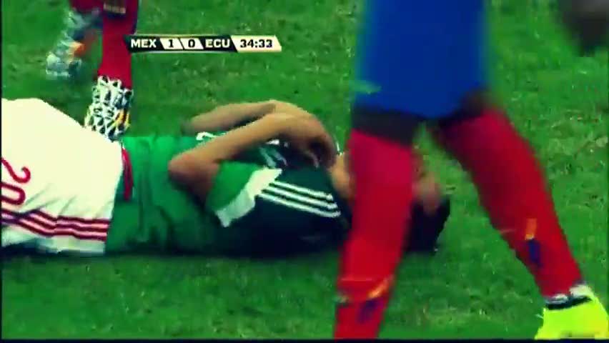 Futbolcunun ayağı böyle kırıldı