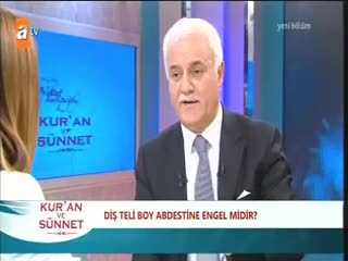 Diş teli gusül abdestine engel mi?