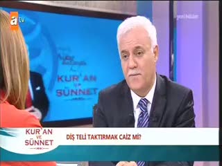 Diş teli taktırmak caiz mi?