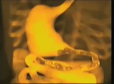 Baş ağrısı ve migren hangi bitkilerle tedavi edilebilir?