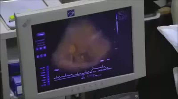 Hamile kızın annesine müthiş ultrason şakası