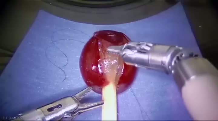 Üzüme dikiş atan robot