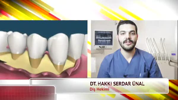 Diş eti çekilmesi nasıl tedavi edilir? videosunu izle Sabah TV