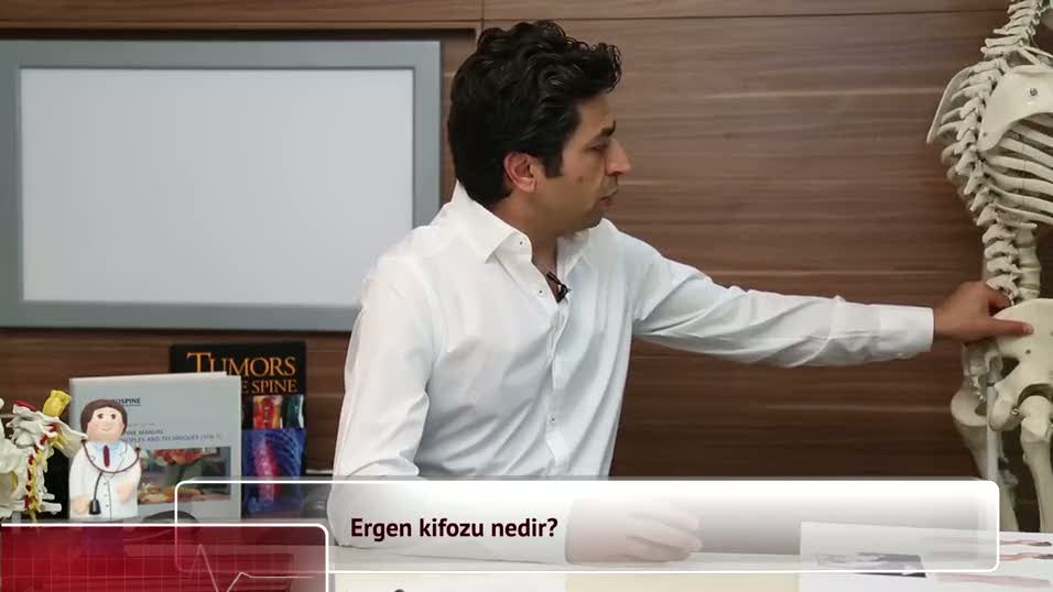 Ergen kifozu nedir?