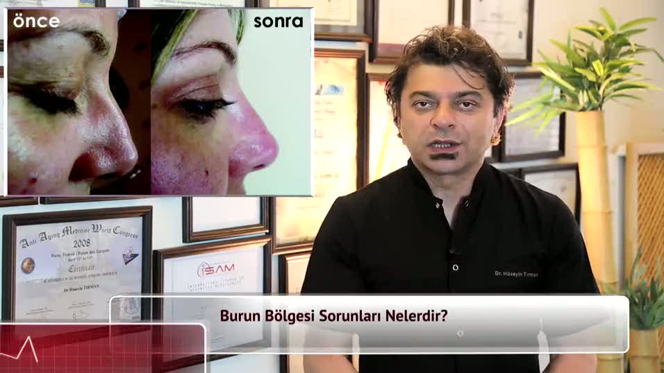 Burun bölgesi sorunları nelerdir?