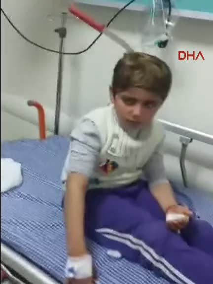 8 yaşındaki çocuğun başına ekmek bıçağı saplandı