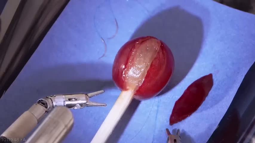 Robot üzüme dikiş attı!