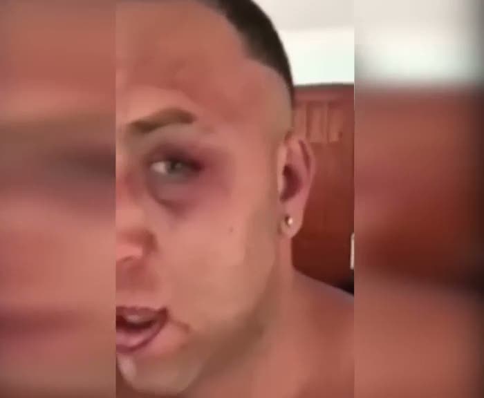 Survivor Taner'i çok fena dövdüler