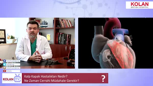 Kalp kapak hastalıkları nedir? Kalp kapak hastalıkları ne zaman Cerrahi gerekir?