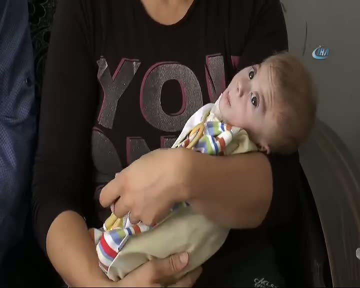 Minik Berat’ın yürek burkan yaşam mücadelesi