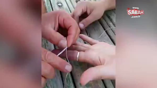 Parmağa sıkışan yüzüğü çıkarmak için ilginç taktik